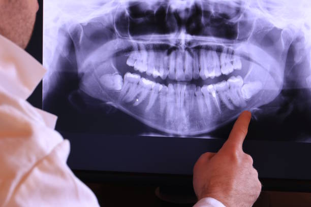 Best Dentist for Tooth Abscess  in Amberley, OH